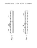 METHODS AND APPARATUS FOR AN ADJUSTABLE STIFFNESS CATHETER diagram and image