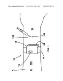 Device and Method for the Reduction of Pain Associated With Needle Sticks diagram and image