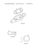 Device For Preventing A Free Catheter Flow diagram and image