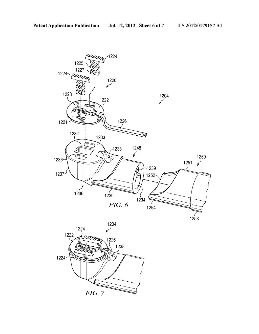 SYSTEMS AND METHODS FOR SCREEN ELECTRODE SECUREMENT - diagram, schematic, and image 07