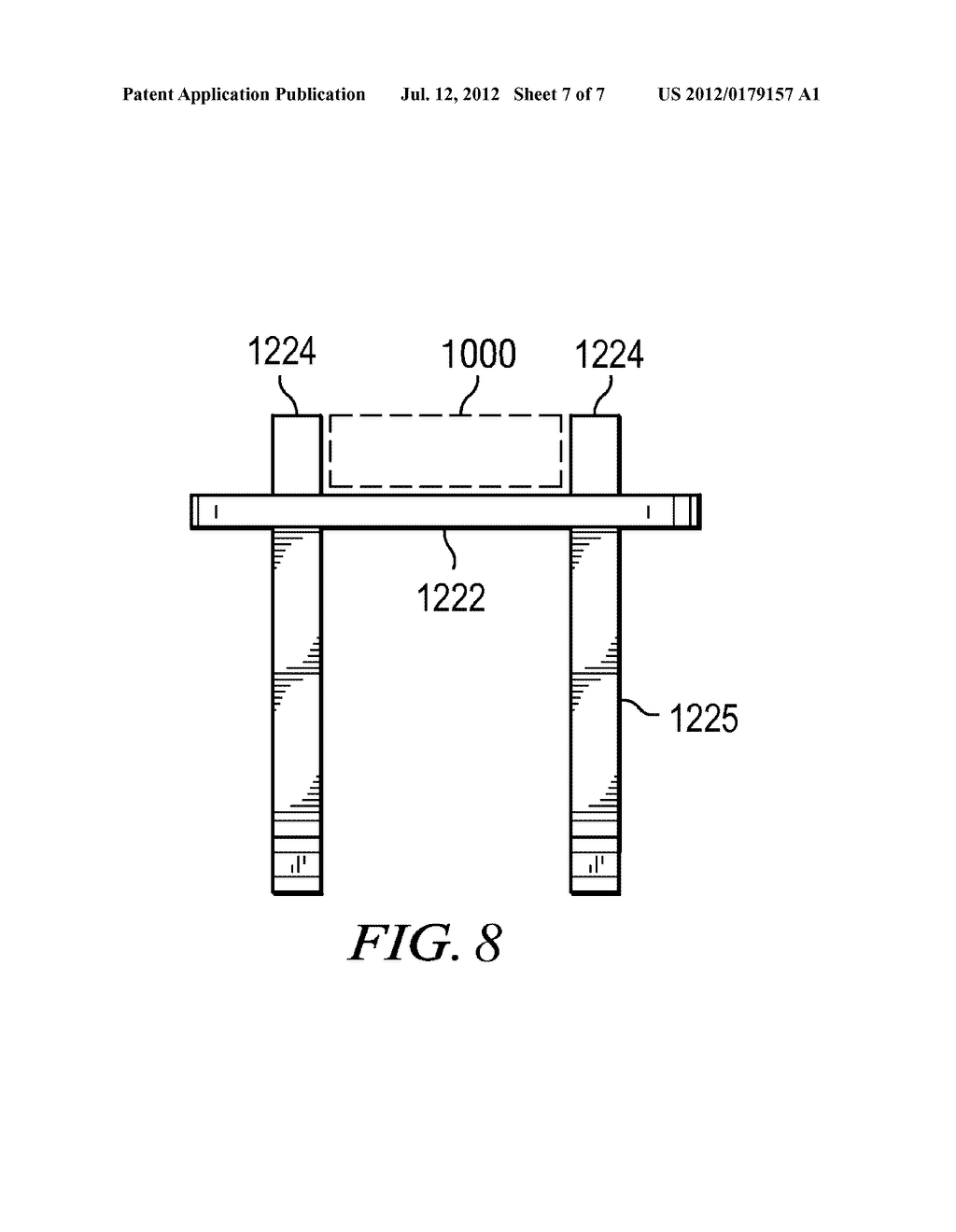 SYSTEMS AND METHODS FOR SCREEN ELECTRODE SECUREMENT - diagram, schematic, and image 08