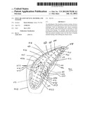 Sinus Ablation Devices, Methods, And Systems diagram and image