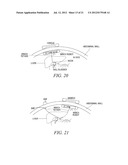 METHODS, SYSTEMS, AND DEVICES FOR SURGICAL ACCESS AND PROCEDURES diagram and image