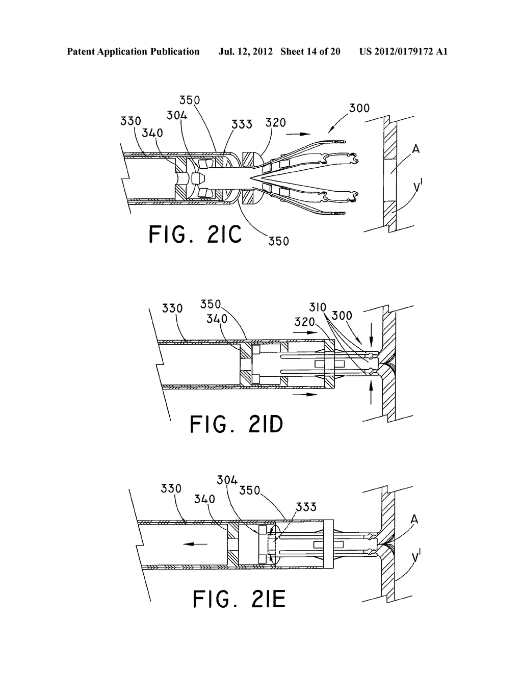 VESSEL CLOSURE DEVICE - diagram, schematic, and image 15