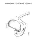 EQUIPMENT TO APPROXIMATE TISSUE PORTIONS, WHICH ARE INTENED TO FORM AN     ANASTOMOSIS, AND A METHOD FOR PERFORMING ANASTOMOSES IN TRACTS OF THE     DIGESTIVE TUBE diagram and image