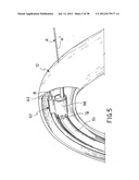 EQUIPMENT TO APPROXIMATE TISSUE PORTIONS, WHICH ARE INTENED TO FORM AN     ANASTOMOSIS, AND A METHOD FOR PERFORMING ANASTOMOSES IN TRACTS OF THE     DIGESTIVE TUBE diagram and image