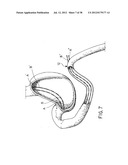 EQUIPMENT TO APPROXIMATE TISSUE PORTIONS, WHICH ARE INTENED TO FORM AN     ANASTOMOSIS, AND A METHOD FOR PERFORMING ANASTOMOSES IN TRACTS OF THE     DIGESTIVE TUBE diagram and image