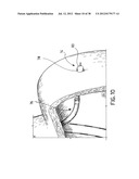 EQUIPMENT TO APPROXIMATE TISSUE PORTIONS, WHICH ARE INTENED TO FORM AN     ANASTOMOSIS, AND A METHOD FOR PERFORMING ANASTOMOSES IN TRACTS OF THE     DIGESTIVE TUBE diagram and image