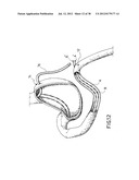 EQUIPMENT TO APPROXIMATE TISSUE PORTIONS, WHICH ARE INTENED TO FORM AN     ANASTOMOSIS, AND A METHOD FOR PERFORMING ANASTOMOSES IN TRACTS OF THE     DIGESTIVE TUBE diagram and image