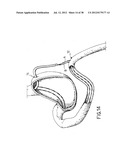 EQUIPMENT TO APPROXIMATE TISSUE PORTIONS, WHICH ARE INTENED TO FORM AN     ANASTOMOSIS, AND A METHOD FOR PERFORMING ANASTOMOSES IN TRACTS OF THE     DIGESTIVE TUBE diagram and image