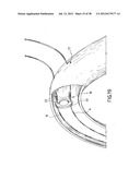 EQUIPMENT TO APPROXIMATE TISSUE PORTIONS, WHICH ARE INTENED TO FORM AN     ANASTOMOSIS, AND A METHOD FOR PERFORMING ANASTOMOSES IN TRACTS OF THE     DIGESTIVE TUBE diagram and image