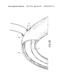 EQUIPMENT TO APPROXIMATE TISSUE PORTIONS, WHICH ARE INTENED TO FORM AN     ANASTOMOSIS, AND A METHOD FOR PERFORMING ANASTOMOSES IN TRACTS OF THE     DIGESTIVE TUBE diagram and image