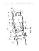 EQUIPMENT TO APPROXIMATE TISSUE PORTIONS, WHICH ARE INTENED TO FORM AN     ANASTOMOSIS, AND A METHOD FOR PERFORMING ANASTOMOSES IN TRACTS OF THE     DIGESTIVE TUBE diagram and image