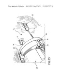 EQUIPMENT TO APPROXIMATE TISSUE PORTIONS, WHICH ARE INTENED TO FORM AN     ANASTOMOSIS, AND A METHOD FOR PERFORMING ANASTOMOSES IN TRACTS OF THE     DIGESTIVE TUBE diagram and image