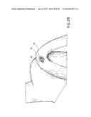 EQUIPMENT TO APPROXIMATE TISSUE PORTIONS, WHICH ARE INTENED TO FORM AN     ANASTOMOSIS, AND A METHOD FOR PERFORMING ANASTOMOSES IN TRACTS OF THE     DIGESTIVE TUBE diagram and image