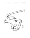 EQUIPMENT TO APPROXIMATE TISSUE PORTIONS, WHICH ARE INTENED TO FORM AN     ANASTOMOSIS, AND A METHOD FOR PERFORMING ANASTOMOSES IN TRACTS OF THE     DIGESTIVE TUBE diagram and image