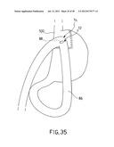 EQUIPMENT TO APPROXIMATE TISSUE PORTIONS, WHICH ARE INTENED TO FORM AN     ANASTOMOSIS, AND A METHOD FOR PERFORMING ANASTOMOSES IN TRACTS OF THE     DIGESTIVE TUBE diagram and image