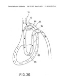 EQUIPMENT TO APPROXIMATE TISSUE PORTIONS, WHICH ARE INTENED TO FORM AN     ANASTOMOSIS, AND A METHOD FOR PERFORMING ANASTOMOSES IN TRACTS OF THE     DIGESTIVE TUBE diagram and image