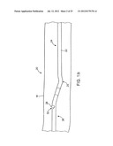 METHOD OF EVALUATING A TREATMENT FOR VASCULAR DISEASE diagram and image