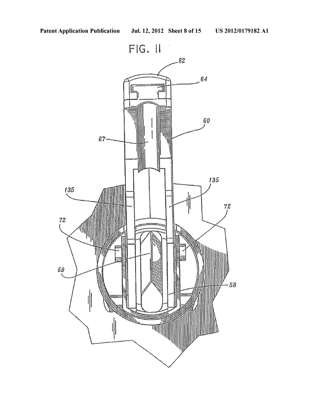 ULTRASONIC CURVED BLADE - diagram, schematic, and image 09