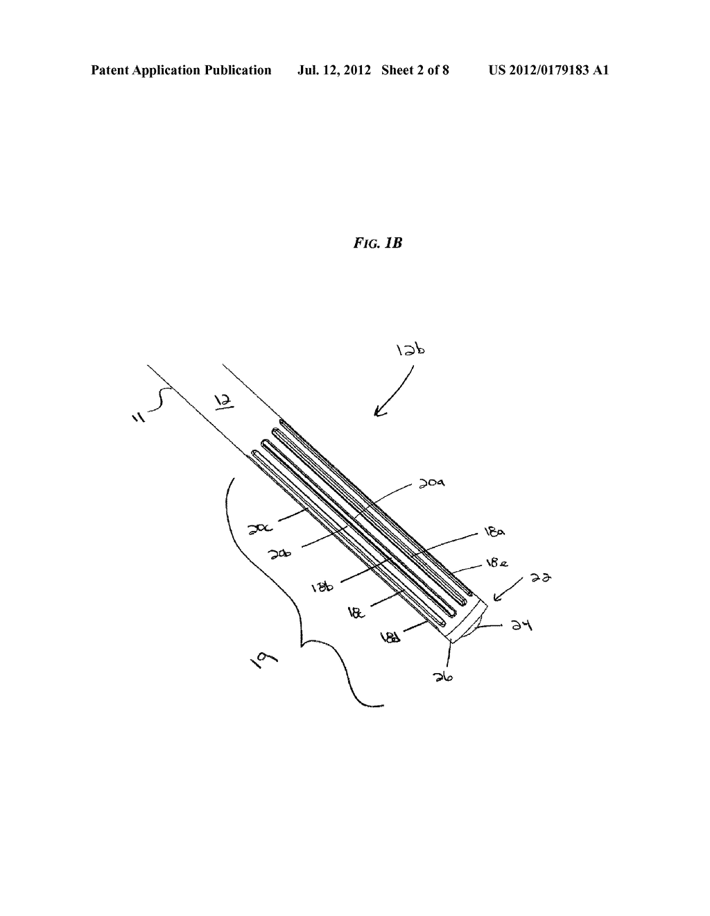 DISC NUCLEUS REMOVAL DEVICES AND METHODS - diagram, schematic, and image 03