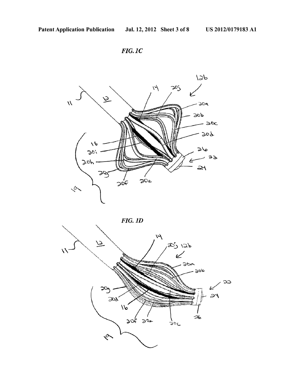 DISC NUCLEUS REMOVAL DEVICES AND METHODS - diagram, schematic, and image 04