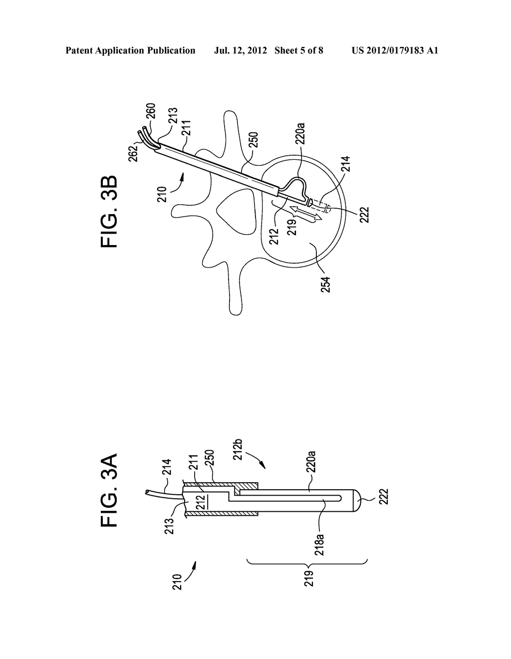 DISC NUCLEUS REMOVAL DEVICES AND METHODS - diagram, schematic, and image 06