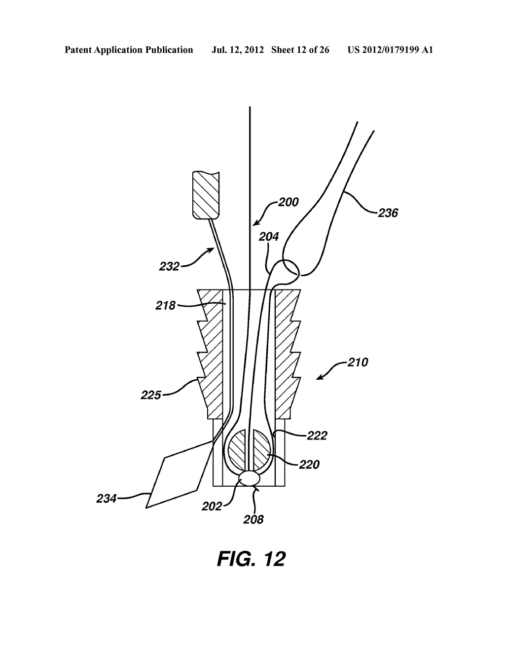 ADJUSTABLE ANCHOR SYSTEMS AND METHODS - diagram, schematic, and image 13