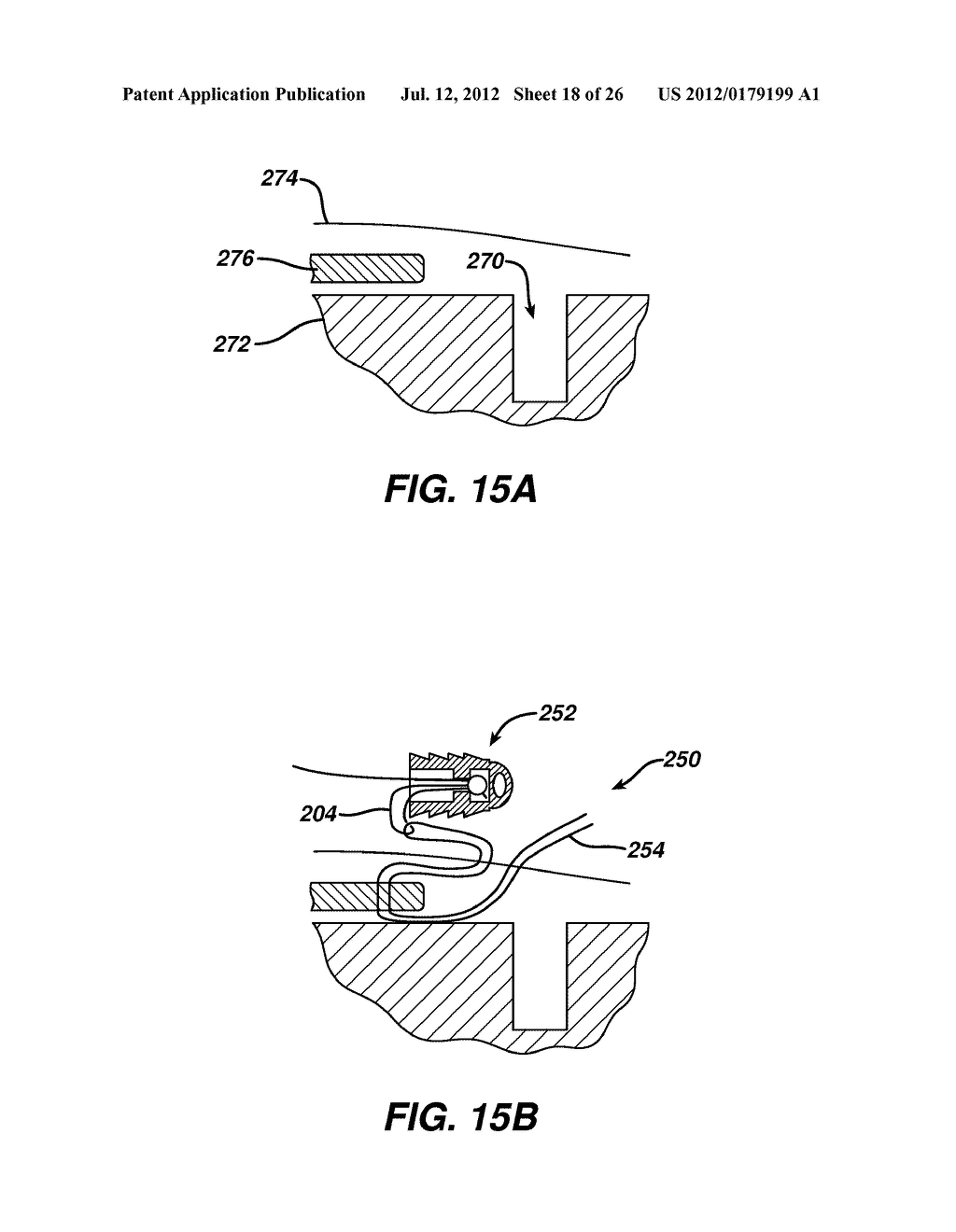 ADJUSTABLE ANCHOR SYSTEMS AND METHODS - diagram, schematic, and image 19
