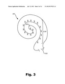 METHODS AND SYSTEMS OF COMPENSATING FOR A DISABLED ELECTRODE diagram and image