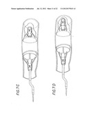 METHODS AND APPARATUSES FOR DEPLOYING MINIMALLY-INVASIVE HEART VALVES diagram and image