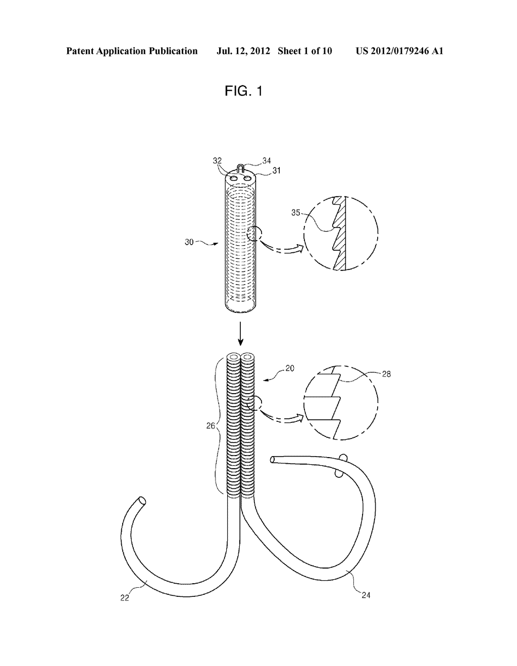 MITRAL VALVE CERCLARGE ANNULOPLASTY APPRATUS AND METHOD THEREOF - diagram, schematic, and image 02