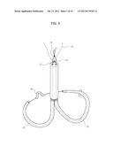 MITRAL VALVE CERCLARGE ANNULOPLASTY APPRATUS AND METHOD THEREOF diagram and image