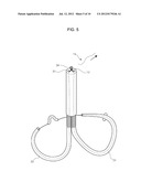 MITRAL VALVE CERCLARGE ANNULOPLASTY APPRATUS AND METHOD THEREOF diagram and image