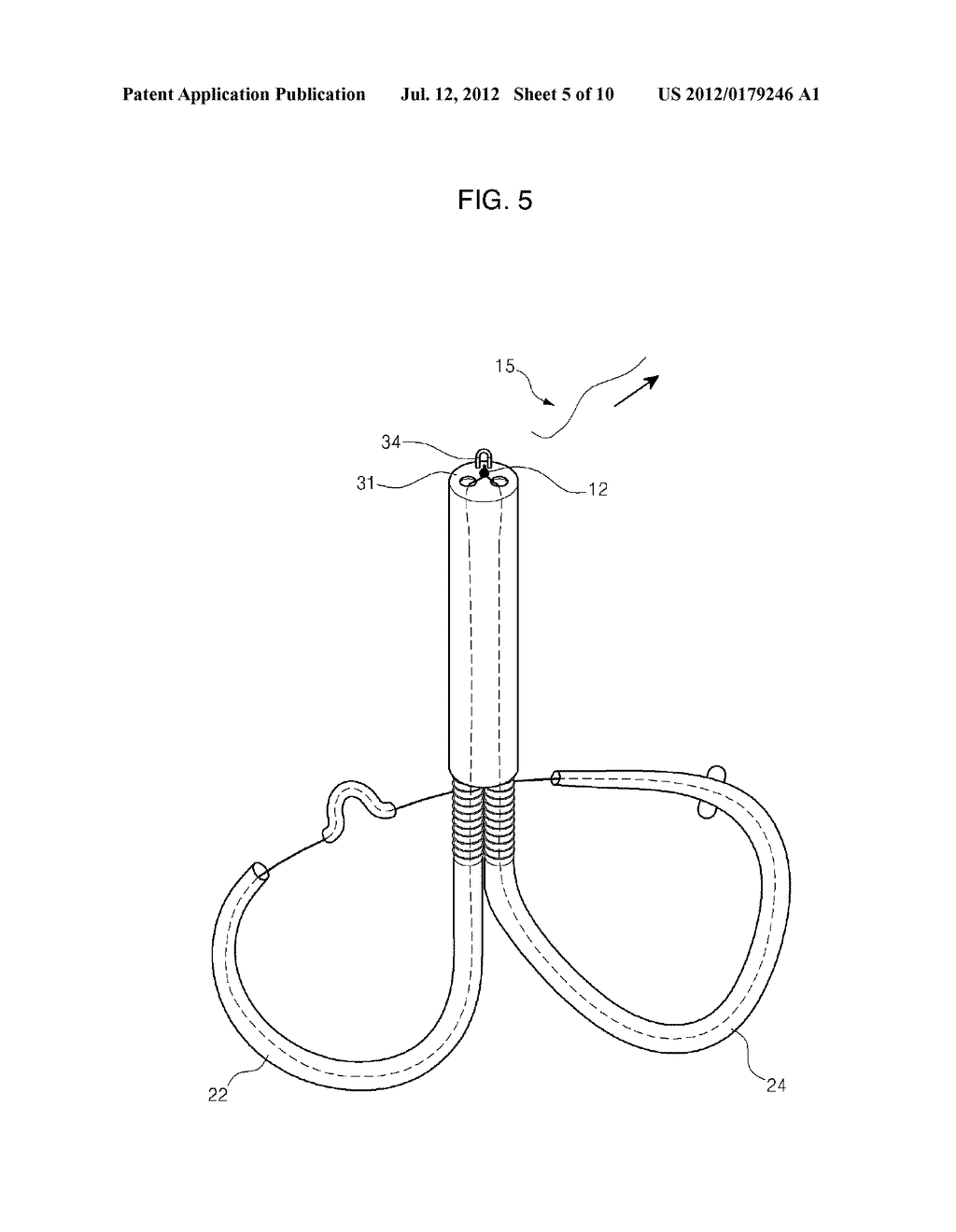 MITRAL VALVE CERCLARGE ANNULOPLASTY APPRATUS AND METHOD THEREOF - diagram, schematic, and image 06