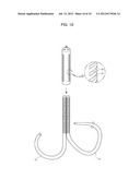 MITRAL VALVE CERCLARGE ANNULOPLASTY APPRATUS AND METHOD THEREOF diagram and image