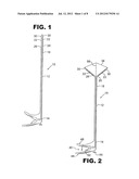 SYSTEM AND METHOD FOR BREAST AUGMENTATION diagram and image