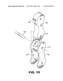 SYSTEM AND METHOD FOR BREAST AUGMENTATION diagram and image