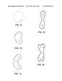 SYSTEM AND METHOD FOR BREAST AUGMENTATION diagram and image