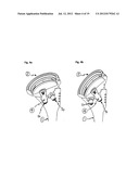 HUMERAL COMPONENT OF A SHOULDER PROSTHESIS AND METHODS OF SHOULDER     ARTHROPLASTY diagram and image