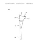 HUMERAL COMPONENT OF A SHOULDER PROSTHESIS AND METHODS OF SHOULDER     ARTHROPLASTY diagram and image