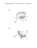 HUMERAL COMPONENT OF A SHOULDER PROSTHESIS AND METHODS OF SHOULDER     ARTHROPLASTY diagram and image