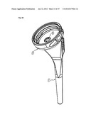 HUMERAL COMPONENT OF A SHOULDER PROSTHESIS AND METHODS OF SHOULDER     ARTHROPLASTY diagram and image