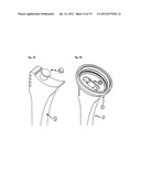 HUMERAL COMPONENT OF A SHOULDER PROSTHESIS AND METHODS OF SHOULDER     ARTHROPLASTY diagram and image