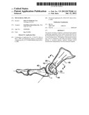 Metatarsal Implant diagram and image