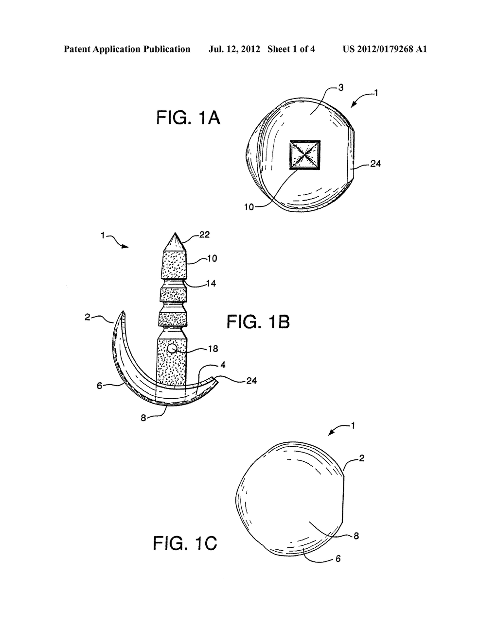 Metatarsal Implant - diagram, schematic, and image 02