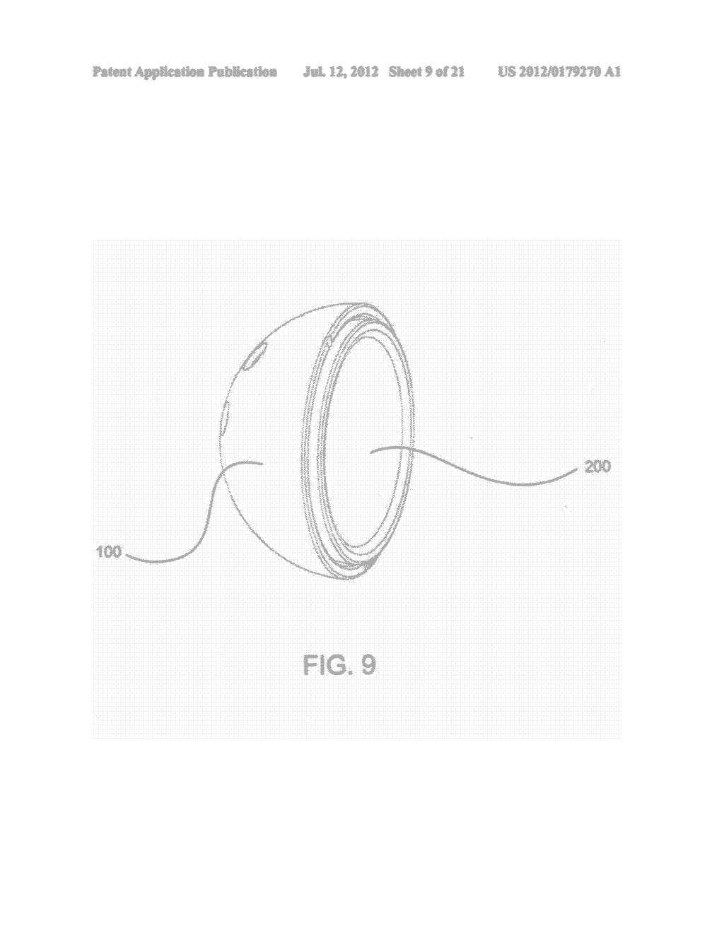 LOW STRESS MULTIPLE FIXATION ACETABULAR COMPONENT - diagram, schematic, and image 10