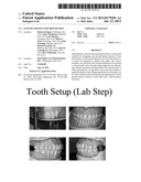 SYSTEMS FOR DENTURE PREPARATION diagram and image