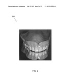 SYSTEMS FOR DENTURE PREPARATION diagram and image