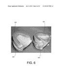 SYSTEMS FOR DENTURE PREPARATION diagram and image